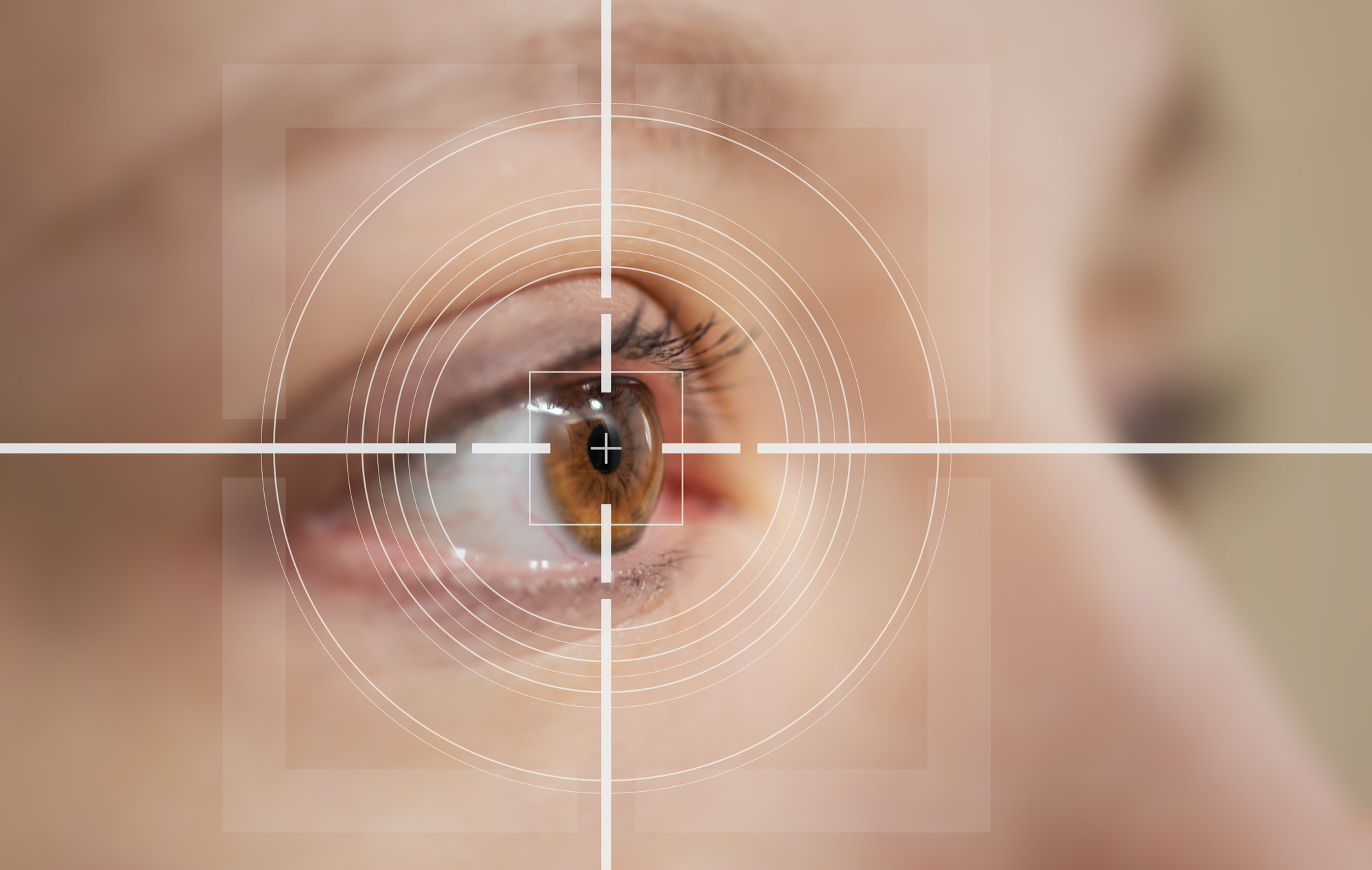 Who Are the Ideal Candidates for LASIK Surgery?