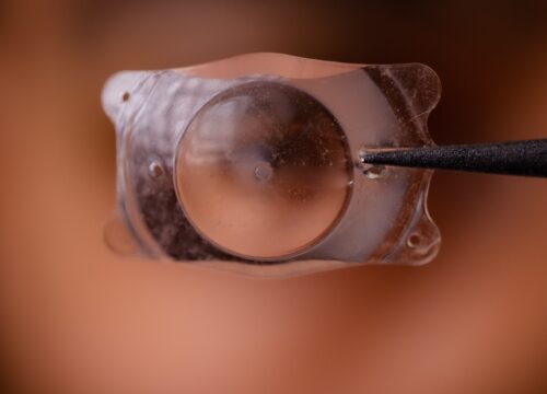 Photo of an ICL implantable lens