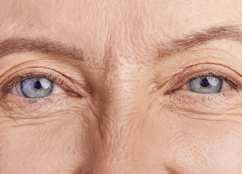 Cataracts & Glaucoma: Can They Be Treated at the Same Time?