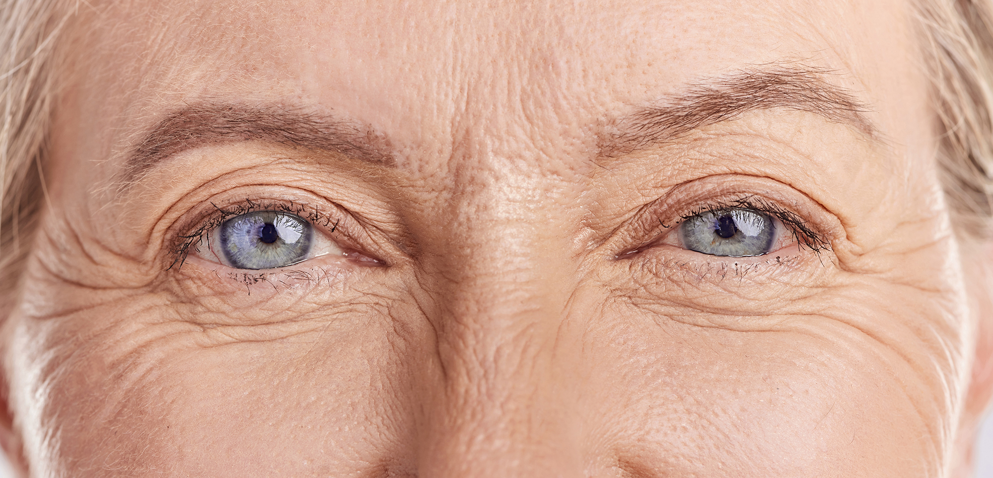 Cataracts and Glaucoma: Can They Be Treated at the Same Time?